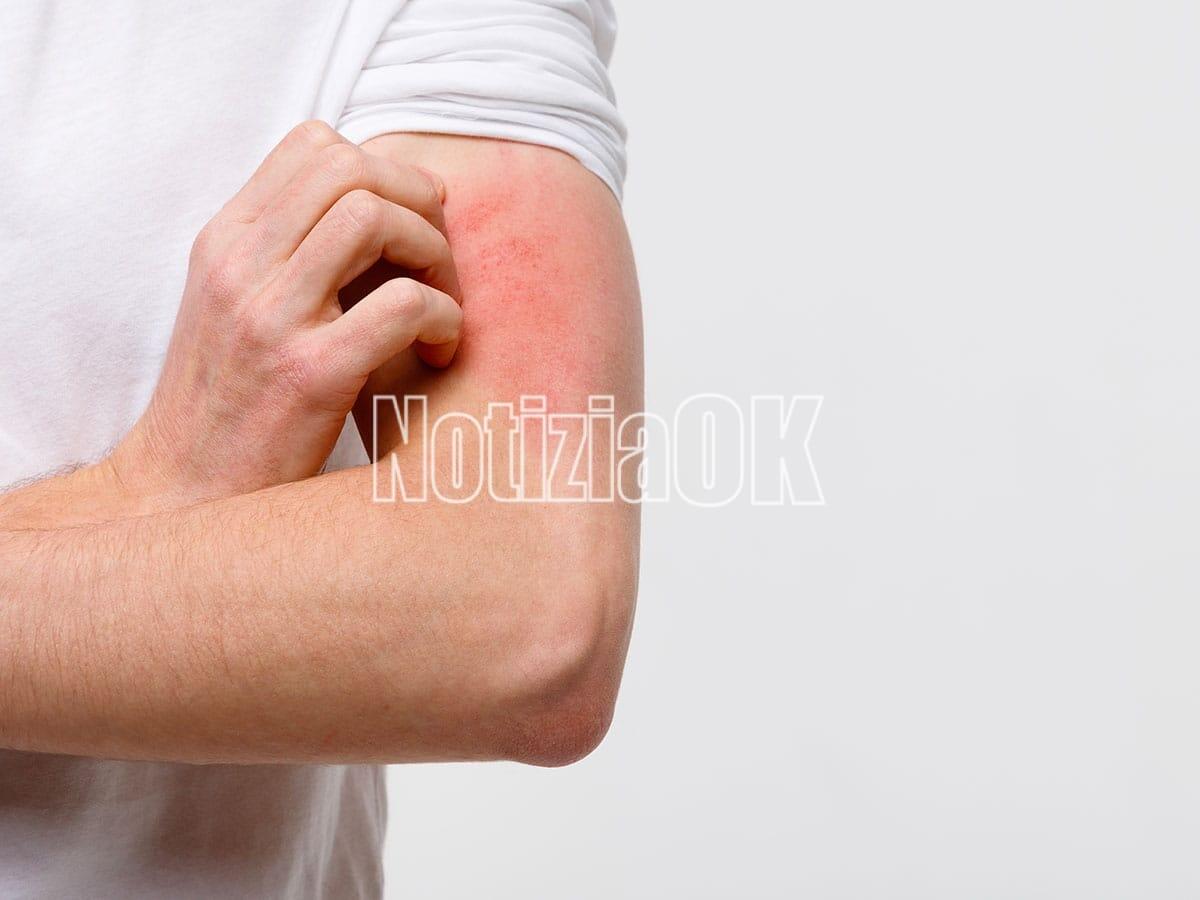 Salute - Tornano le Giornata dermatologiche calabresi - 