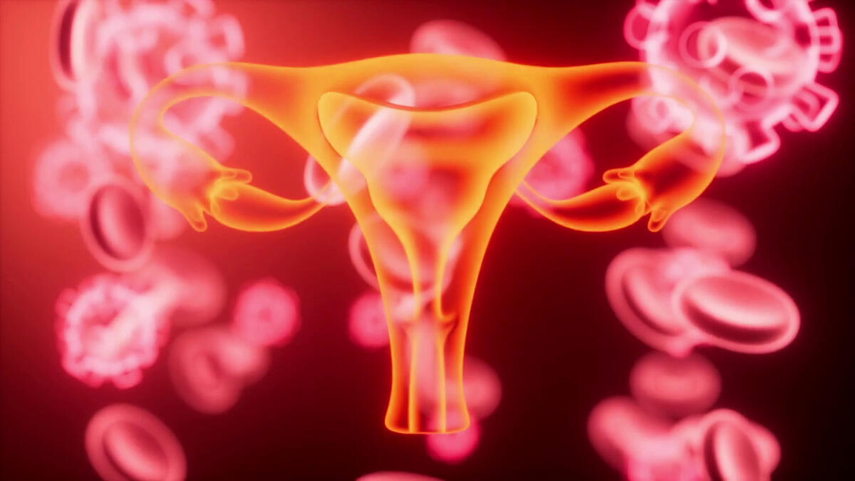 Un vaccino contro il tumore dell’endometrio - 
