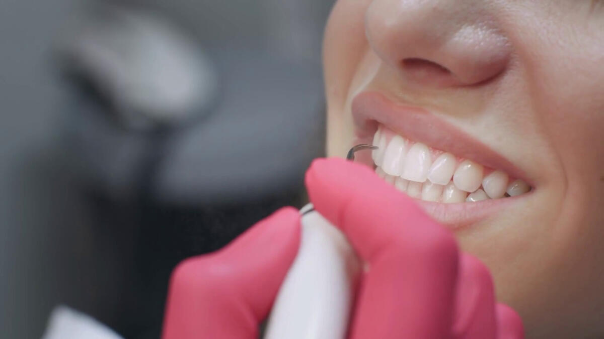 La parodontologia e la ricetta per "salvare" i nostri denti - 