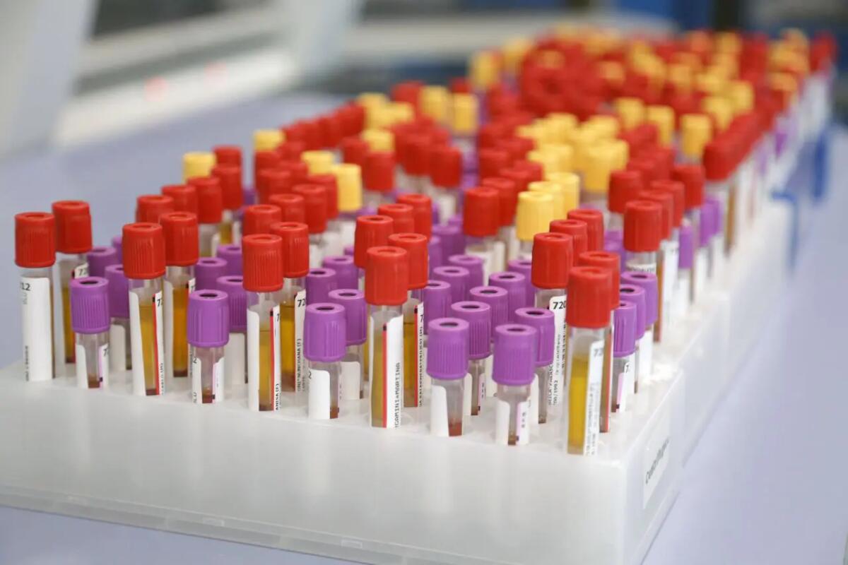 Botulino, Meo (Artemisia Lab) “Attenzione alle conserve fatte in casa” -
