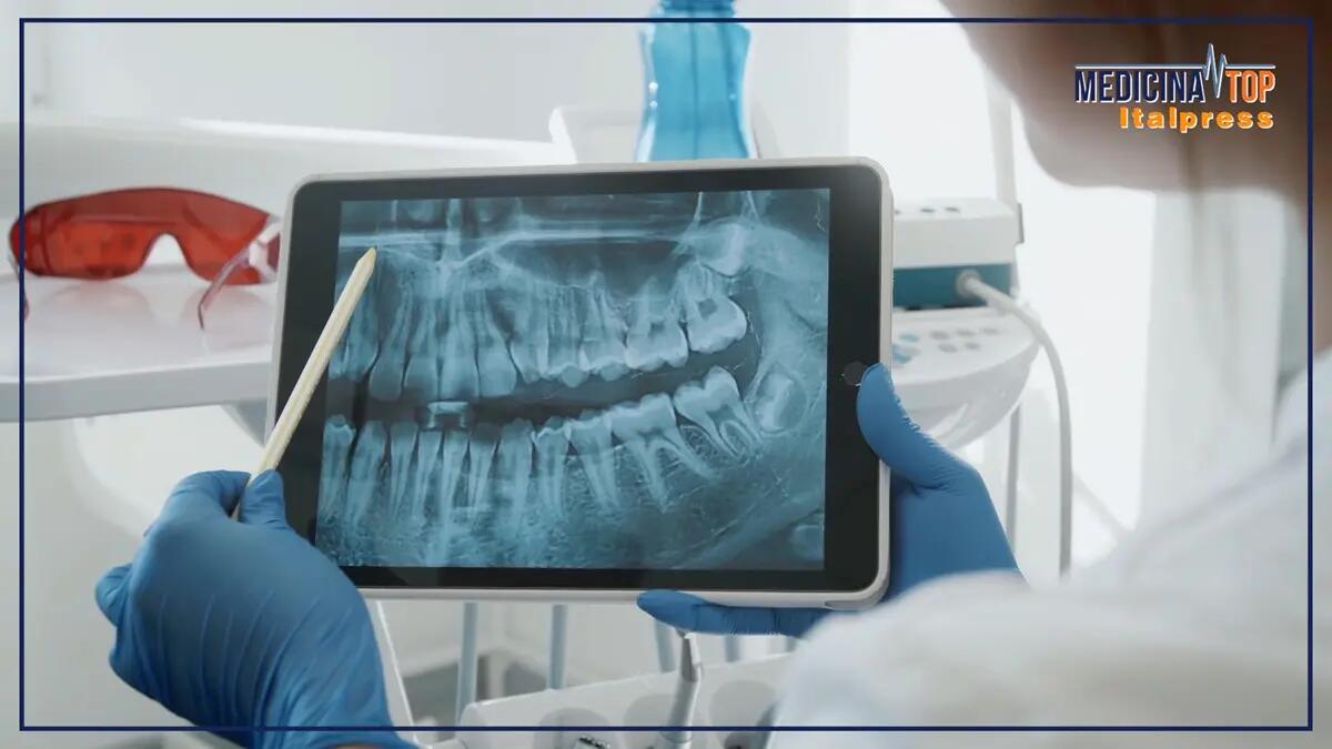 Per preservare la salute dei denti educare i giovani a una corretta igiene orale - 