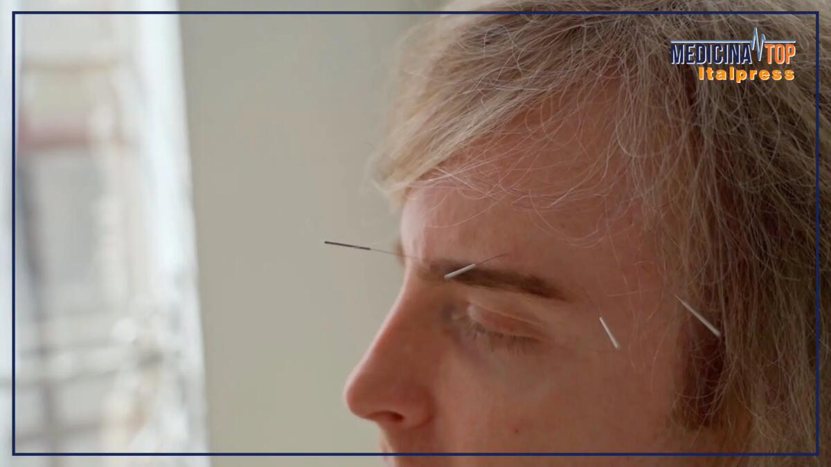 Agopuntura pratica terapeutica millenaria, ecco perché parlarne è utile - 