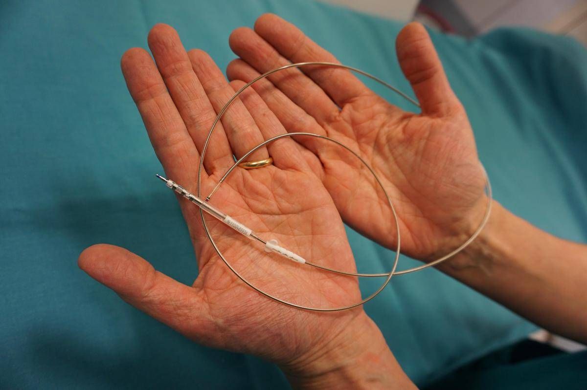 Medicina, 'filo' sottile 1,5 mm contro morte cardiaca improvvisa, a Bergamo primi interventi - 