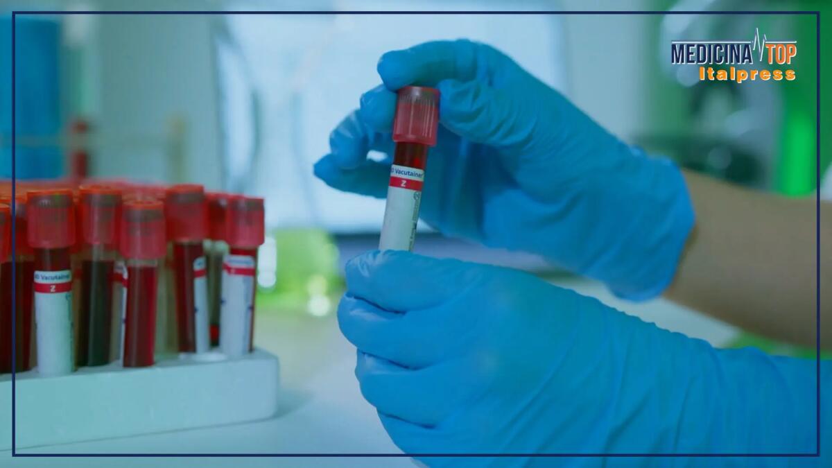 Donazione del sangue, Italia autosufficiente. Ma sul plasma servono passi avanti - 