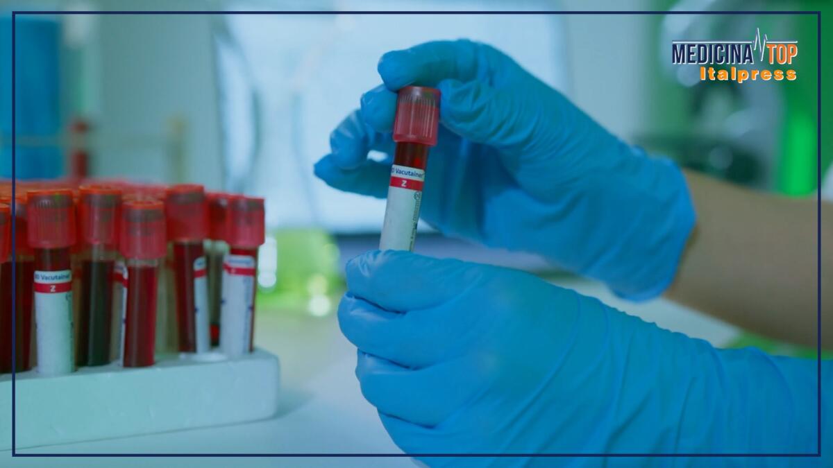 Donazione del sangue, Italia autosufficiente. Ma sul plasma servono passi avanti - 