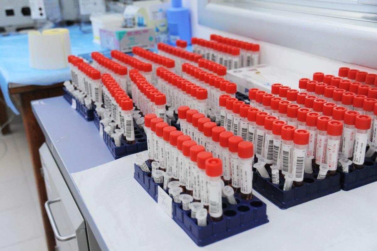 Alla Run Rome The Marathon screening gratuito degli anticorpi per diabete e celiachia per gli under 18 - 