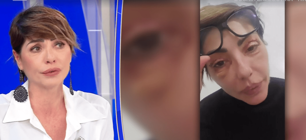 Ilaria Galassi, insulti social per i ritocchi estetici: "Offese anche sui miei figli" - 