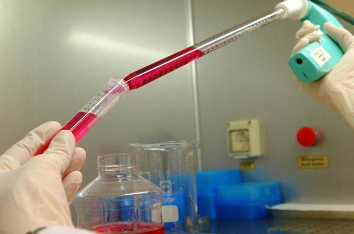 Melanoma uveale metastatico: "Tebentafusp raddoppia sopravvivenza a 5 anni" - 