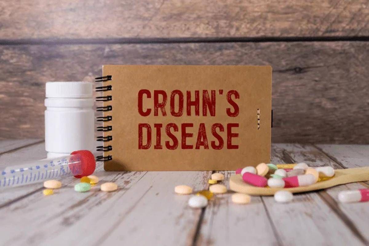 Malattia Crohn con fistole, nuovi dati su terapia monoclonale - 
