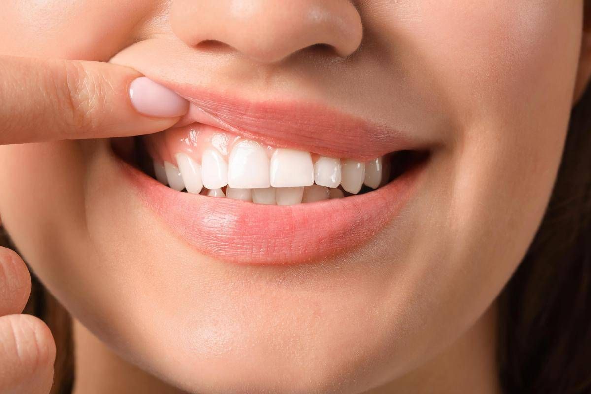 Denti a rischio tra i giovani, Sidp: "Il 36% della Gen Z ha gengive che sanguinano" - 