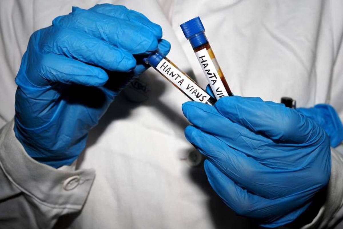 Hantavirus, Ema monitora diffusione: "Pronti a supportare iter vaccini" - 