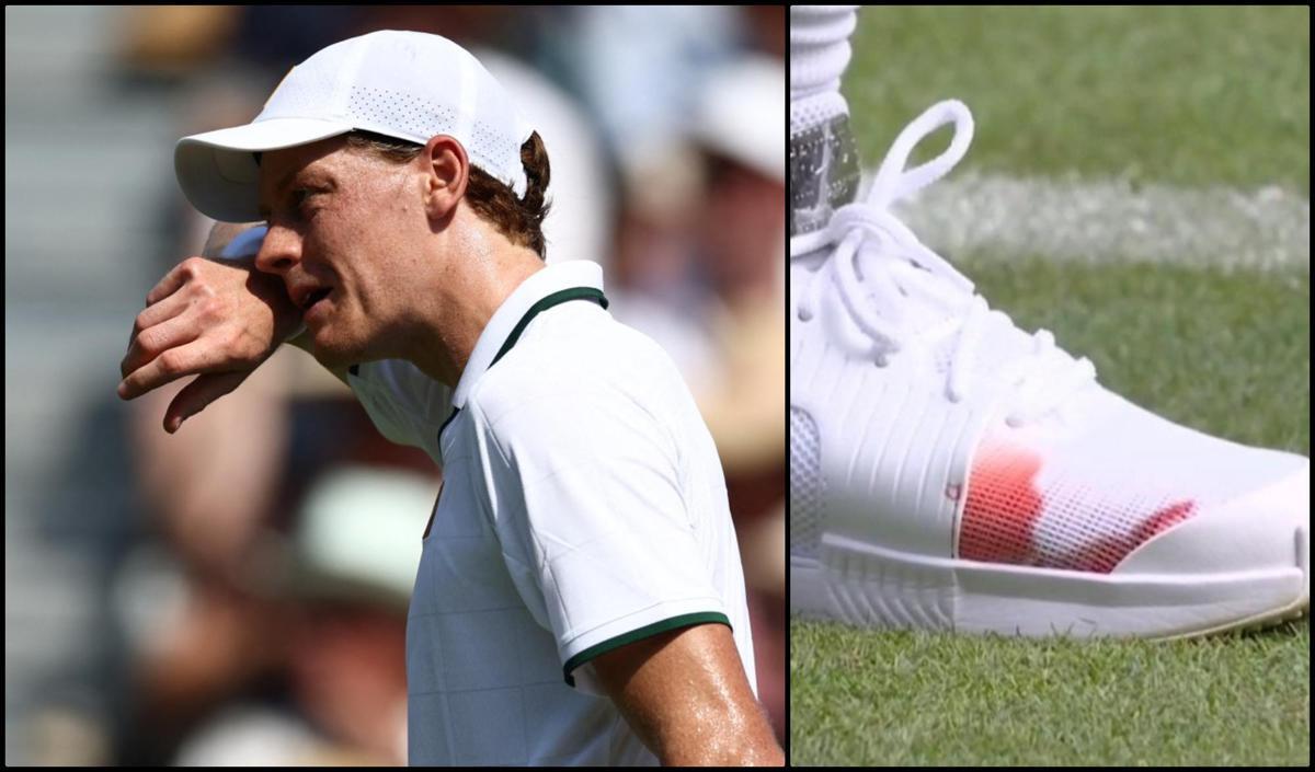 Sinner: "Scarpa insanguinata? Era solo un'unghia..." - 