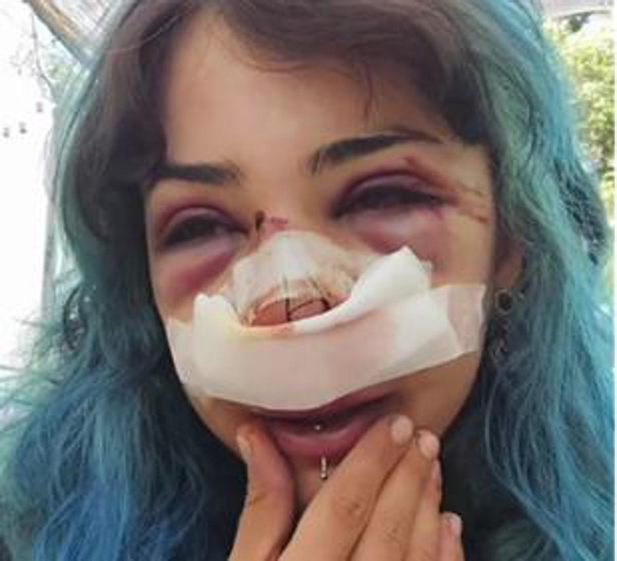 Bari, studentessa picchiata al parco: indagati per lesioni e rapina custode bagni e il compagno - 