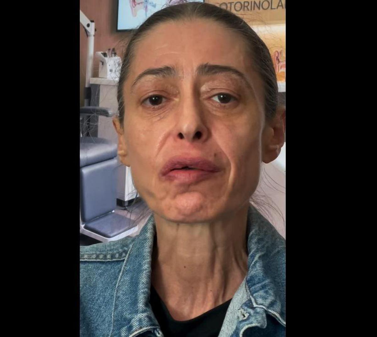 Gerardina Trovato annulla il tour: "Devo operarmi d'urgenza" - 