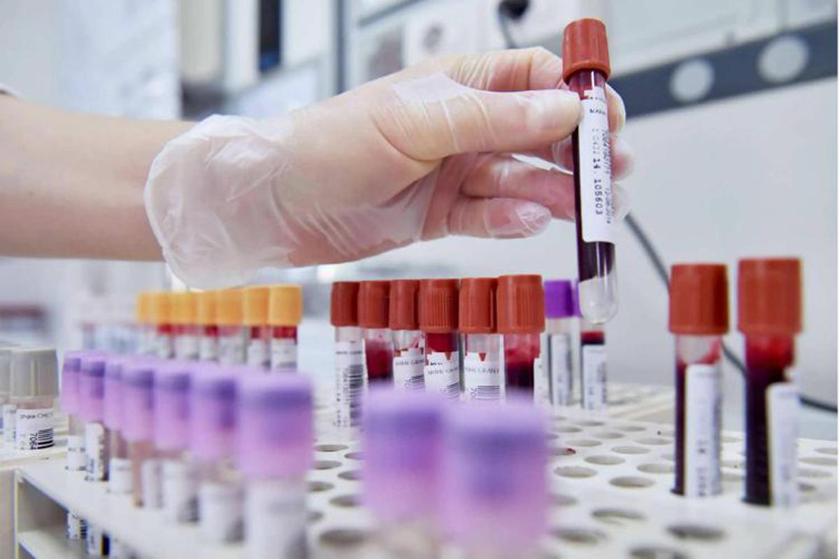 Dal microbiota una speranza contro l'epilessia resistente, lo studio italiano - 