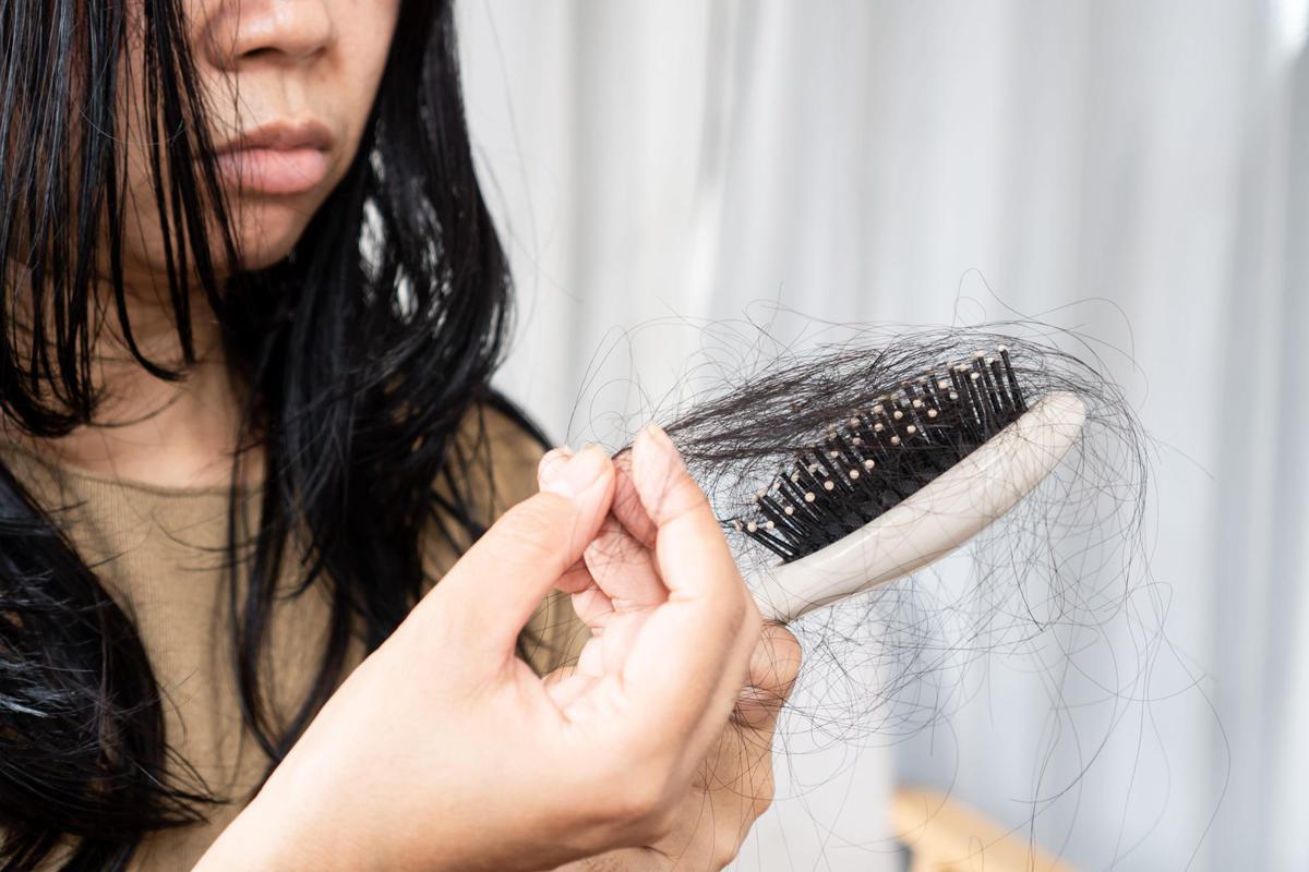 Con nuovi farmaci anti diabete e obesità più rischi di perdere i capelli, lo studio - 