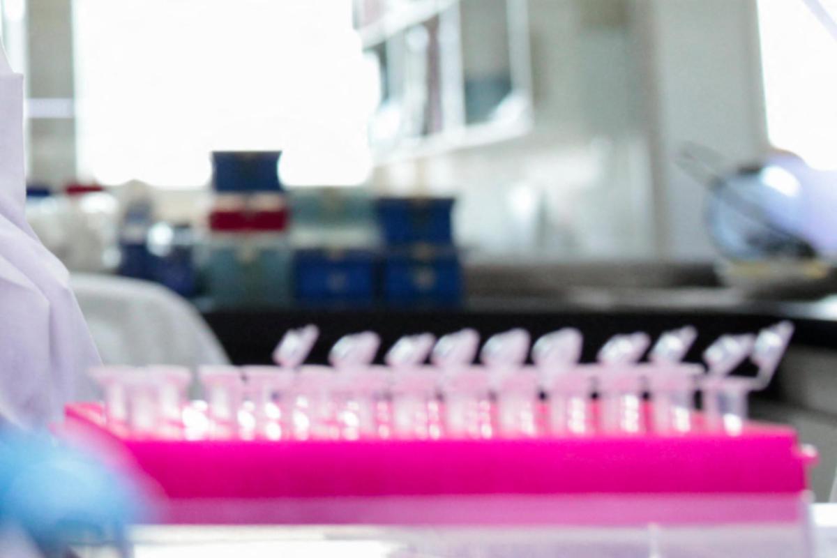 Milano, focolaio di tubercolosi all'Istituto di Medicina legale: 8 casi conclamati e 7 positivi. Indagini sull'origine del contagio - 