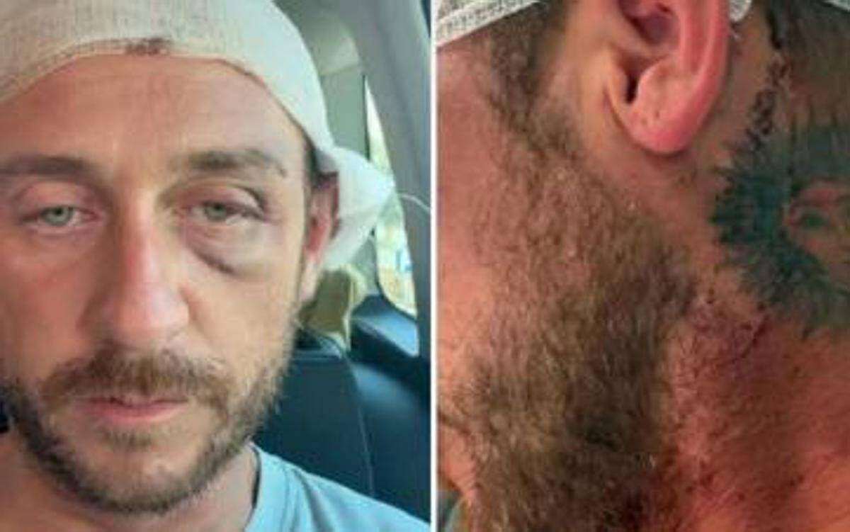 "Io aggredito a sassate in Sardegna da 30 persone perché gay", la denuncia sui social ﻿ - 