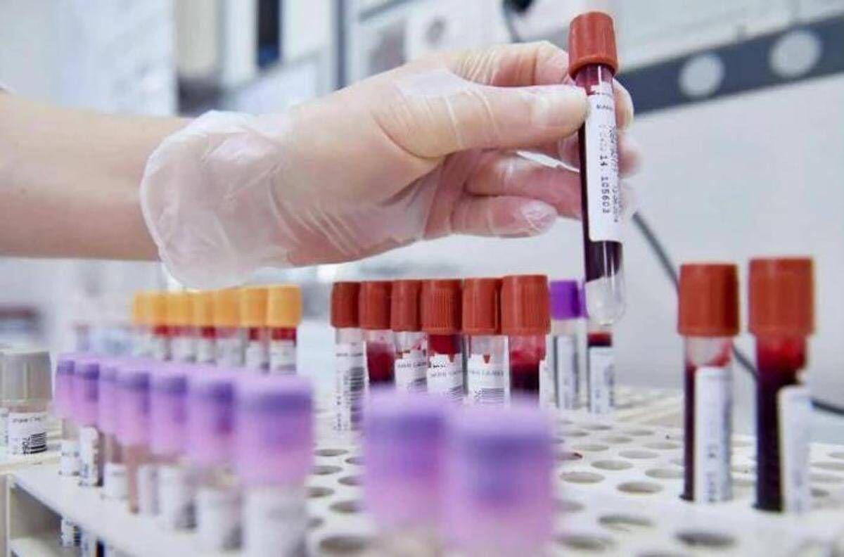 Sclerosi multipla recidivante, Ema raccomanda approvazione ocrelizumab dai 10 anni - 