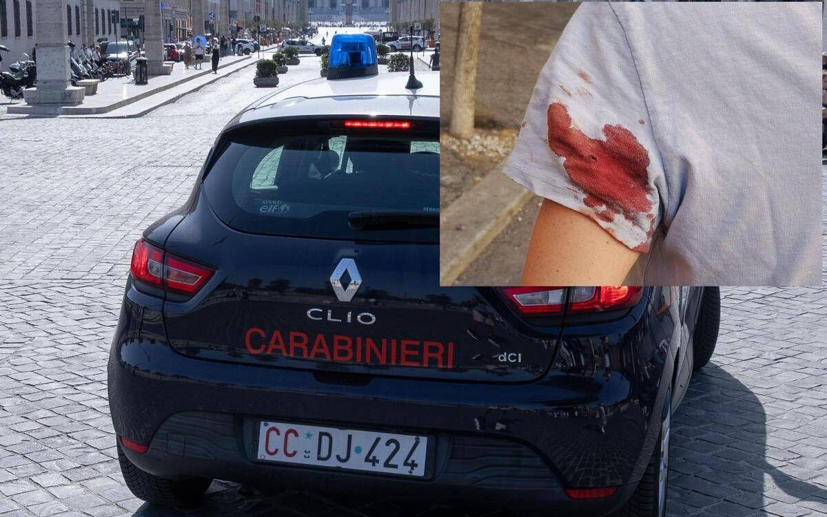 Spari con arma ad aria compressa in centro a Roma, la donna colpita: "Mi hanno detto che si ripetono da giorni" - 