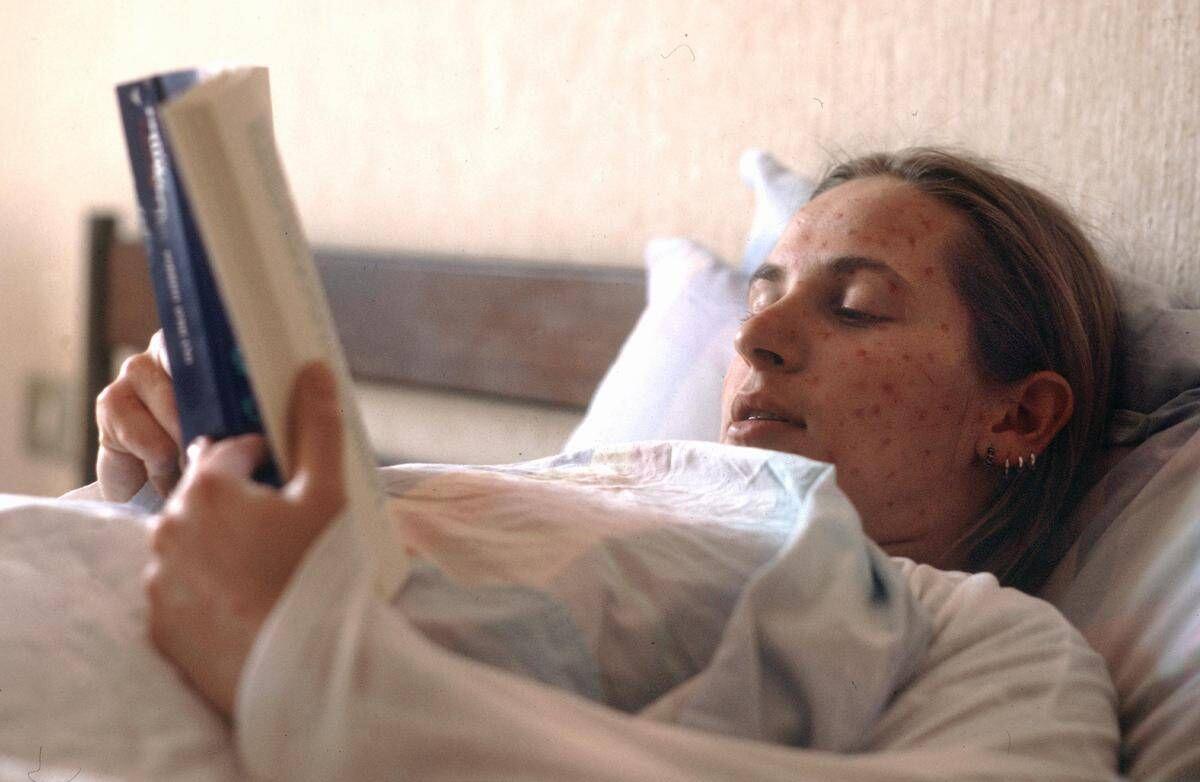 Morbillo in Italia, il Ministero: "Possibile criticità in copertura vaccinale, c'è rischio di aumento della circolazione" - 