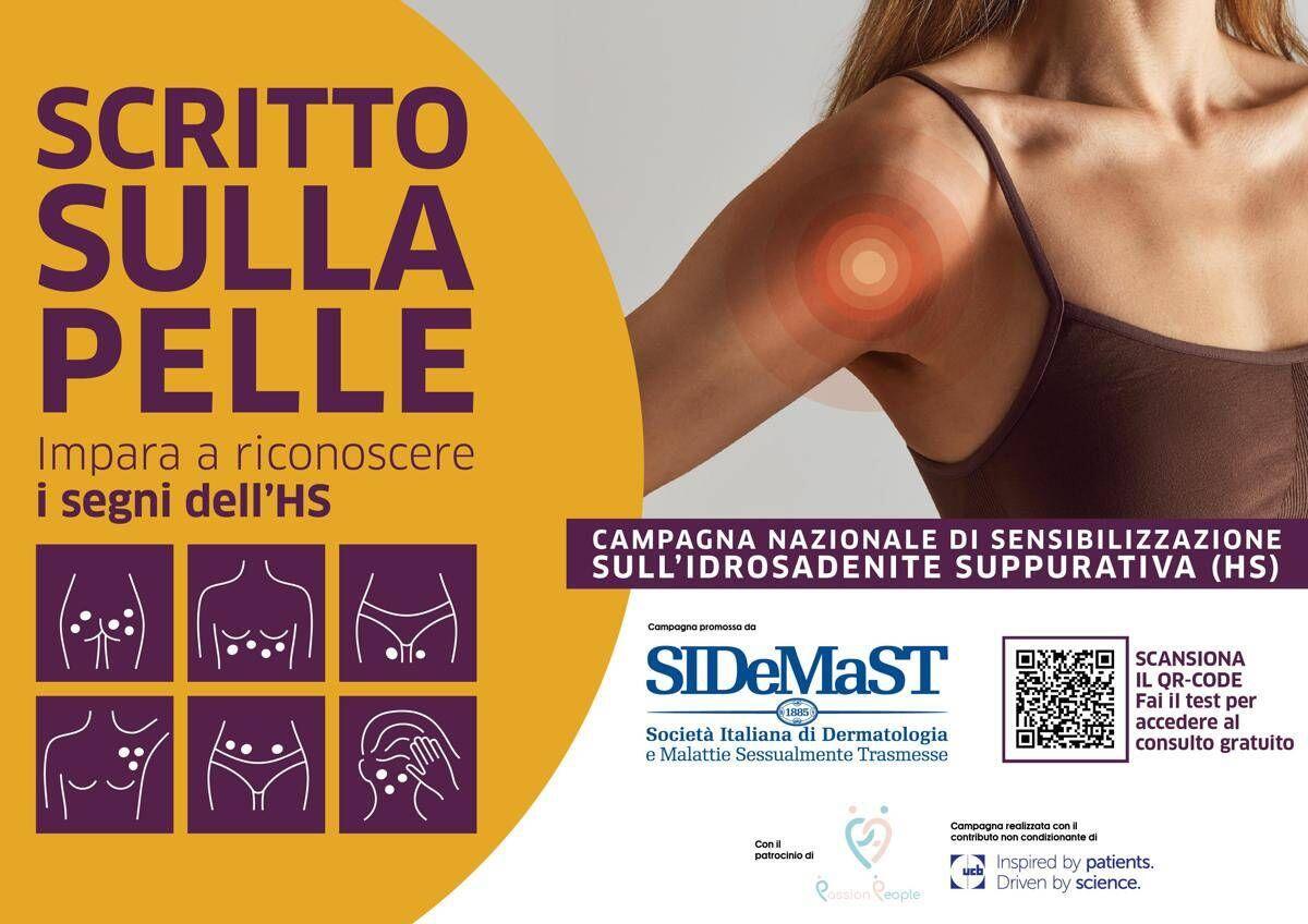 Idrosadenite suppurativa, al via campagna di sensibilizzazione 'Scritto sulla pelle' - 